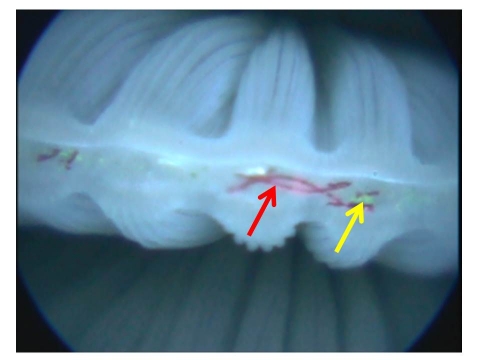  An image through a microscope shows microfibers inside the body of an oyster.